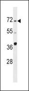 Sphingosine Kinase 2 antibody, PA5-14070, Invitrogen Antibodies, Western Blot image 