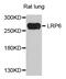 LDL Receptor Related Protein 6 antibody, PA5-76195, Invitrogen Antibodies, Western Blot image 