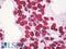 Nucleophosmin 1 antibody, LS-B8557, Lifespan Biosciences, Immunohistochemistry paraffin image 