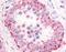 Phosphodiesterase 11A antibody, orb86312, Biorbyt, Immunohistochemistry paraffin image 