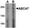 ATP Binding Cassette Subfamily A Member 1 antibody, LS-C153710, Lifespan Biosciences, Western Blot image 