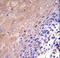 Glutamate-Cysteine Ligase Catalytic Subunit antibody, LS-C166412, Lifespan Biosciences, Immunohistochemistry paraffin image 