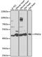 Protein Phosphatase, Mg2+/Mn2+ Dependent 1K antibody, 16-674, ProSci, Western Blot image 