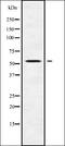 Gasdermin E antibody, orb338501, Biorbyt, Western Blot image 