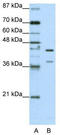 HNRPK antibody, TA345792, Origene, Western Blot image 