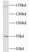Histone-lysine N-methyltransferase NSD3 antibody, FNab05863, FineTest, Western Blot image 