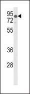 Low Density Lipoprotein Receptor antibody, GTX80914, GeneTex, Western Blot image 