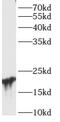 ADP Ribosylation Factor Like GTPase 15 antibody, FNab00573, FineTest, Western Blot image 