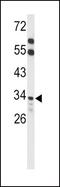 Acyl-CoA Thioesterase 8 antibody, PA5-26152, Invitrogen Antibodies, Western Blot image 