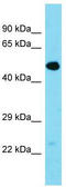Transmembrane Protein 39A antibody, TA330672, Origene, Western Blot image 