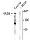 NMDAR2B antibody, PA1-4733, Invitrogen Antibodies, Western Blot image 