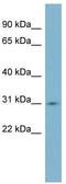 SCO Cytochrome C Oxidase Assembly Protein 1 antibody, TA342223, Origene, Western Blot image 