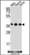 Heterogeneous Nuclear Ribonucleoprotein D Like antibody, 61-897, ProSci, Western Blot image 