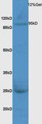 TTK Protein Kinase antibody, GTX51836, GeneTex, Western Blot image 