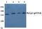 Phospholipase C Gamma 2 antibody, PA5-36722, Invitrogen Antibodies, Western Blot image 