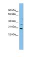 N-Acetyltransferase 2 antibody, orb330372, Biorbyt, Western Blot image 