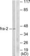 FOS Like 2, AP-1 Transcription Factor Subunit antibody, abx013082, Abbexa, Western Blot image 