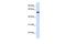 NMDA Receptor Synaptonuclear Signaling And Neuronal Migration Factor antibody, GTX47024, GeneTex, Western Blot image 