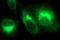 Matrix Metallopeptidase 13 antibody, LS-C788302, Lifespan Biosciences, Immunofluorescence image 