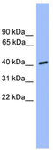 Casein kinase I isoform alpha-like antibody, TA340392, Origene, Western Blot image 