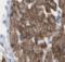 Phosphatidylinositol 3-Kinase Catalytic Subunit Type 3 antibody, FNab09437, FineTest, Immunohistochemistry paraffin image 