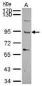 Thrombospondin Type 1 Domain Containing 1 antibody, GTX116397, GeneTex, Western Blot image 