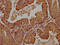 WD Repeat Domain 73 antibody, CSB-PA744047LA01HU, Cusabio, Immunohistochemistry paraffin image 