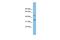 Rh Family B Glycoprotein (Gene/Pseudogene) antibody, GTX46059, GeneTex, Western Blot image 