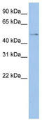 TSPY Like 4 antibody, TA333722, Origene, Western Blot image 