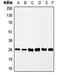 Casein Kinase 2 Beta antibody, LS-C352066, Lifespan Biosciences, Western Blot image 