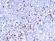 Immunoglobulin Kappa Variable 1D-16 antibody, NBP2-45080, Novus Biologicals, Immunohistochemistry frozen image 