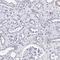 Transient Receptor Potential Cation Channel Subfamily M Member 2 antibody, HPA035260, Atlas Antibodies, Immunohistochemistry frozen image 