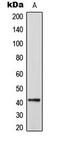 Centrosomal Protein 41 antibody, GTX55235, GeneTex, Western Blot image 