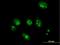 Activator Of Basal Transcription 1 antibody, H00029777-B02P, Novus Biologicals, Immunocytochemistry image 