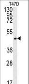 Proenkephalin-A antibody, LS-C163520, Lifespan Biosciences, Western Blot image 