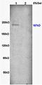 Eukaryotic Translation Initiation Factor 2 Alpha Kinase 4 antibody, orb6078, Biorbyt, Western Blot image 