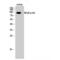 Nuclear Factor Kappa B Subunit 2 antibody, LS-C384869, Lifespan Biosciences, Western Blot image 