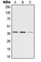Zinc Binding Alcohol Dehydrogenase Domain Containing 2 antibody, GTX55988, GeneTex, Western Blot image 