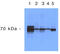 Ribosomal Protein S6 Kinase B1 antibody, MBS395298, MyBioSource, Western Blot image 