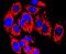 Matrix Metallopeptidase 13 antibody, NBP2-66954, Novus Biologicals, Immunocytochemistry image 