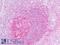 Interleukin 1 Receptor Like 2 antibody, LS-B9085, Lifespan Biosciences, Immunohistochemistry paraffin image 
