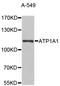 ATPase Na+/K+ Transporting Subunit Alpha 1 antibody, STJ110188, St John