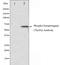 Synaptotagmin 1 antibody, GTX52318, GeneTex, Western Blot image 