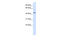 Interleukin 11 Receptor Subunit Alpha antibody, ARP46465_P050, Aviva Systems Biology, Western Blot image 