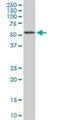 Receptor Interacting Serine/Threonine Kinase 2 antibody, H00008767-M02, Novus Biologicals, Western Blot image 