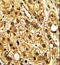 CD11C antibody, PA5-35326, Invitrogen Antibodies, Immunohistochemistry frozen image 
