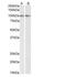 Tripartite Motif Containing 71 antibody, NBP2-27490, Novus Biologicals, Western Blot image 