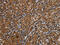Involucrin antibody, CSB-PA779447, Cusabio, Immunohistochemistry paraffin image 