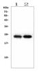 Troponin I2, Fast Skeletal Type antibody, A07355-2, Boster Biological Technology, Western Blot image 