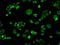 Cytochrome P450 Oxidoreductase antibody, LS-C114676, Lifespan Biosciences, Immunofluorescence image 